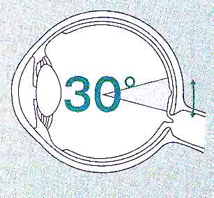 超広角走査レーザー検眼鏡のご案内｜牛久市ひたち野の眼科 ウイング眼科の画像